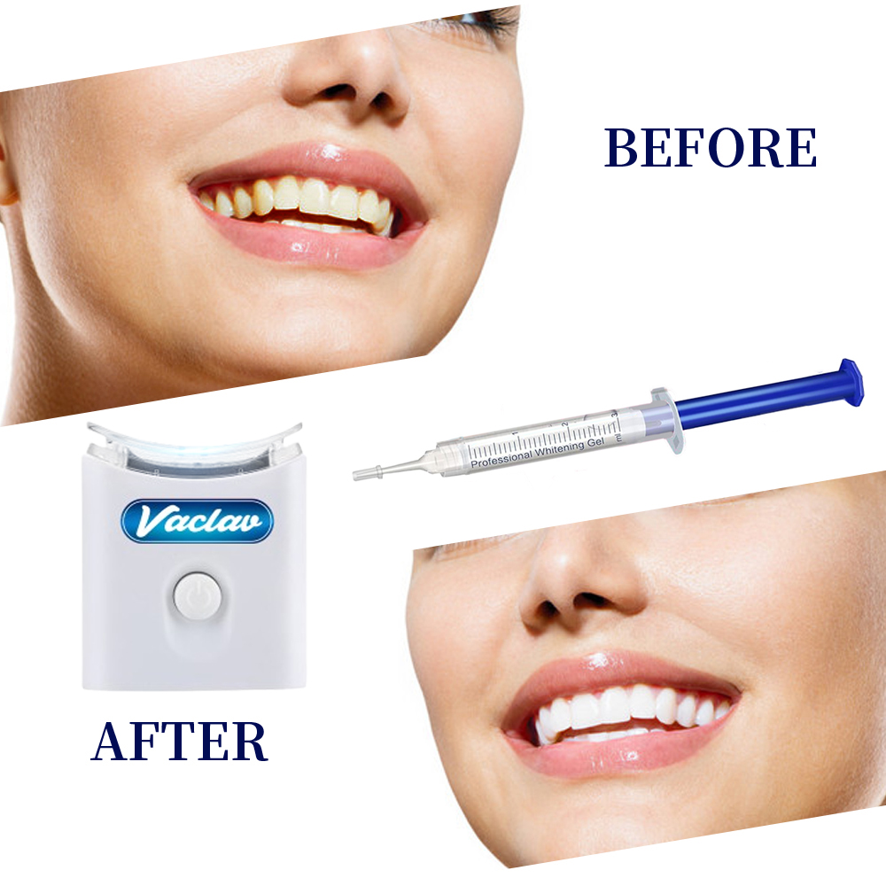 Mint Teeth Whitening Gel Syrin - огляд і ціна Teeth Whitening Gel Syringes