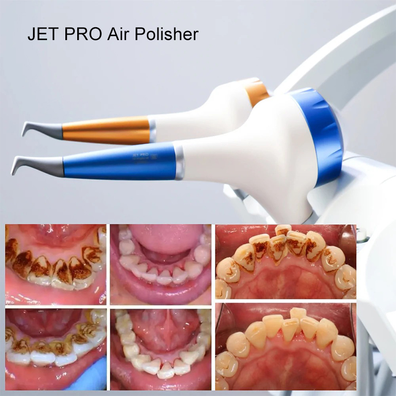 VV Dental  Air Polishing Proph - огляд і ціна Teeth Whitening Free