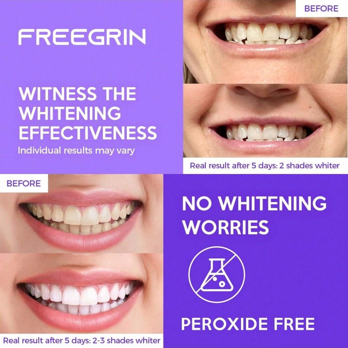 Deluxe Whitening Teeth Sticker - огляд і ціна Teeth Whitening With Hydrogen Peroxide